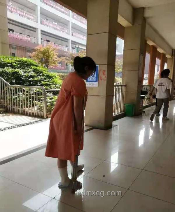 小孩姐骨折后如何安全地在家拄拐行走